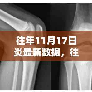 往年11月17日炎最新数据深度解析与观点阐述,全面报告发布及趋势探讨