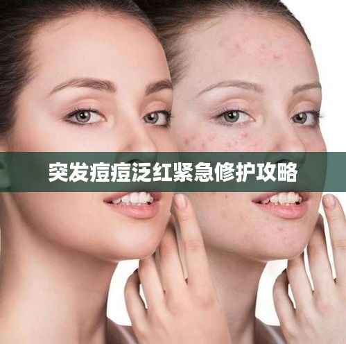 突发痘痘泛红紧急修护攻略